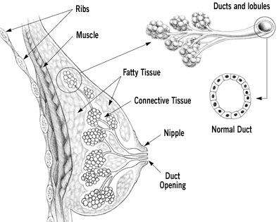 Breast Cancer Surgery in Delhi India