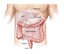 Anal Cancer Treatment in India