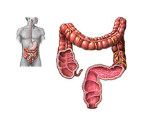 Anal Cancer Treatment in India