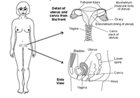 Endometrial Cancer Treatment in India